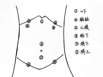 中医腹诊的临床应用